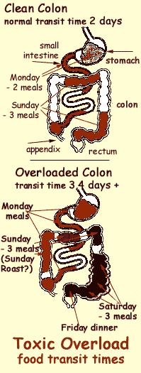 Colonic overload - breeding ground of disease