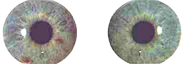 A left-brain dominant Jewel structure