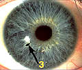 Flower in Grace - right iris