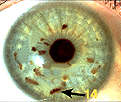 Jewel in creativity - right iris