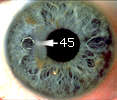 A Flower in heart - right iris