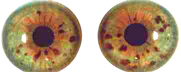 A right-brain dominant Jewel structure