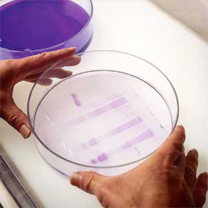 enzymes in a petrie dish